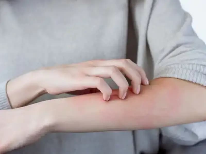 Cilt Kanserinin Sırları: Dermatologdan Gelen İki Önemli Uyarı