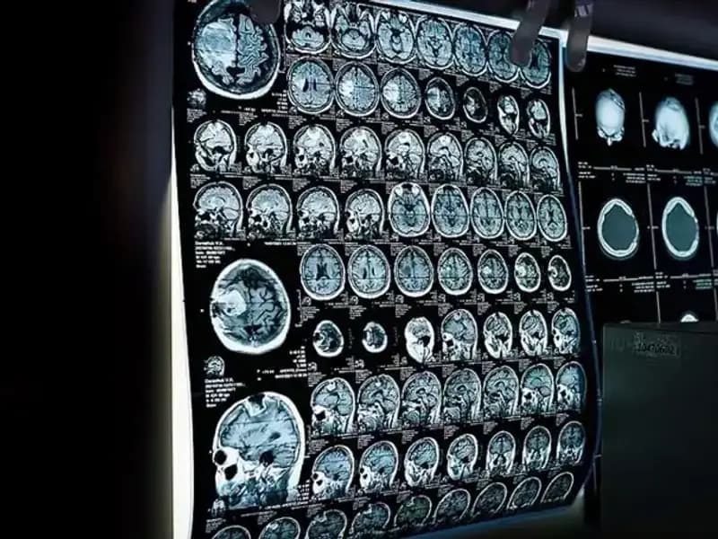 İstanbul'da 81 Bini Aşkın Kişiye Ücretsiz Kanser Taraması Yapıldı