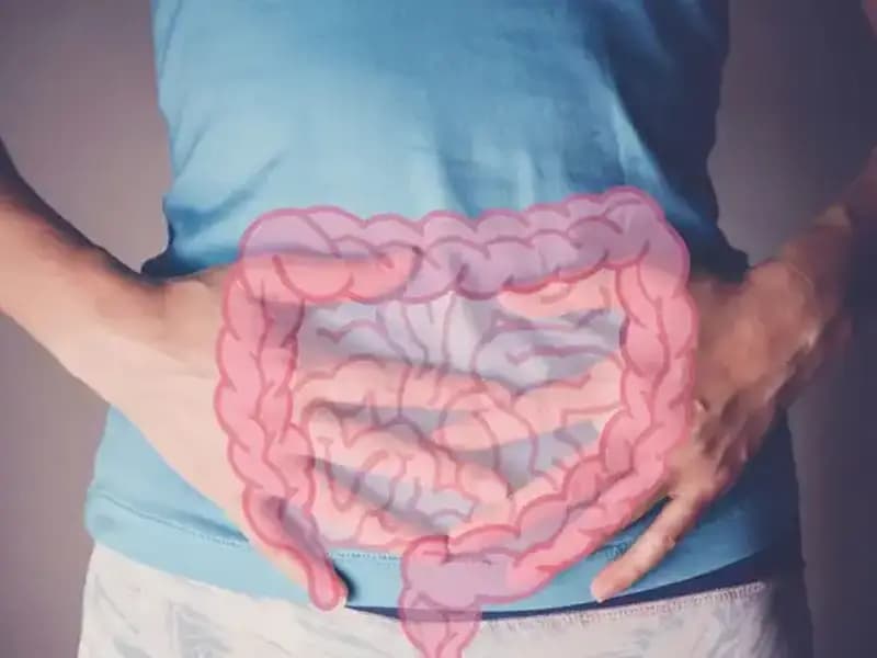 Gençlerde İleri Evre Kolon Kanseri Teşhisi: Uzmanlardan Şaşırtan Açıklamalar