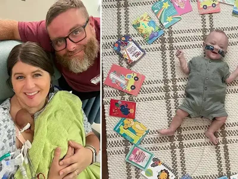 Dünyanın En Prematüre Bebeği: 280 Gramla Hayata Merhaba Dedi