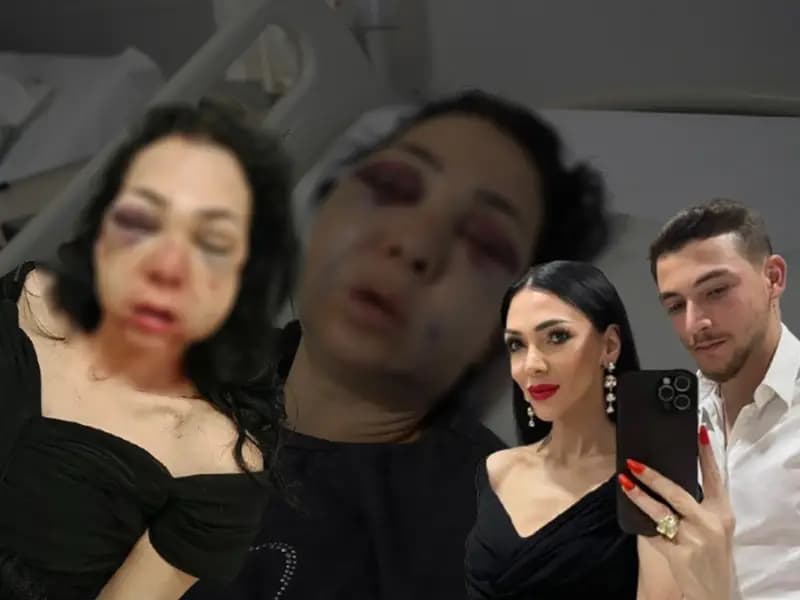 Kocaeli'de Kafede Bayram Dehşeti: Anne ve Oğul Saldırıya Uğradı