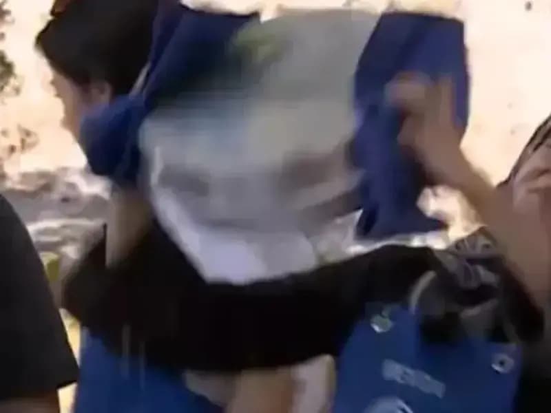 MasterChef Türkiye’de Beyza Talihsiz Kaza Geçirdi: Yüzü Yandı, Görüntüler Yayınlandı