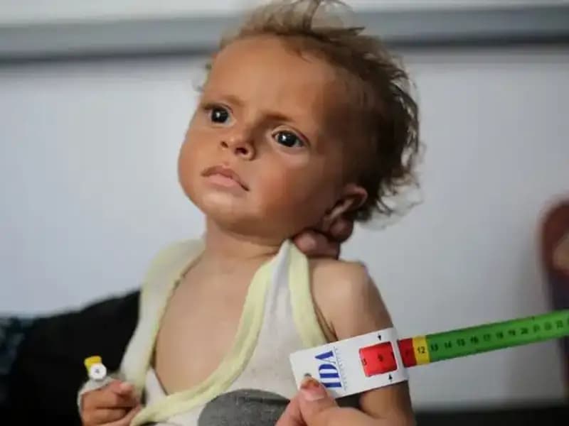 İngiltere, 300 Gazze'li Çocuğa Yeni Bir Yaşam Fırsatı Sunacak