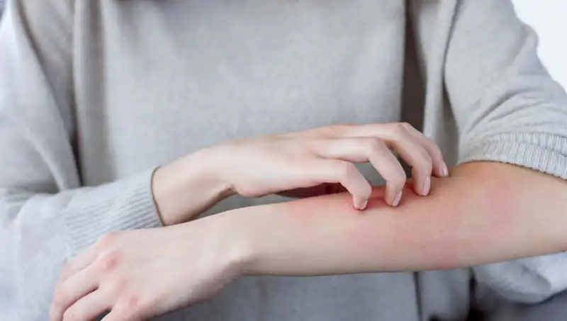 Cilt Kanserinin Sırları: Dermatologdan Gelen İki Önemli Uyarı